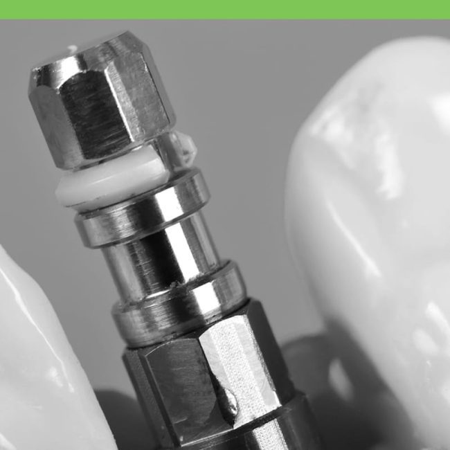 Dental Implants