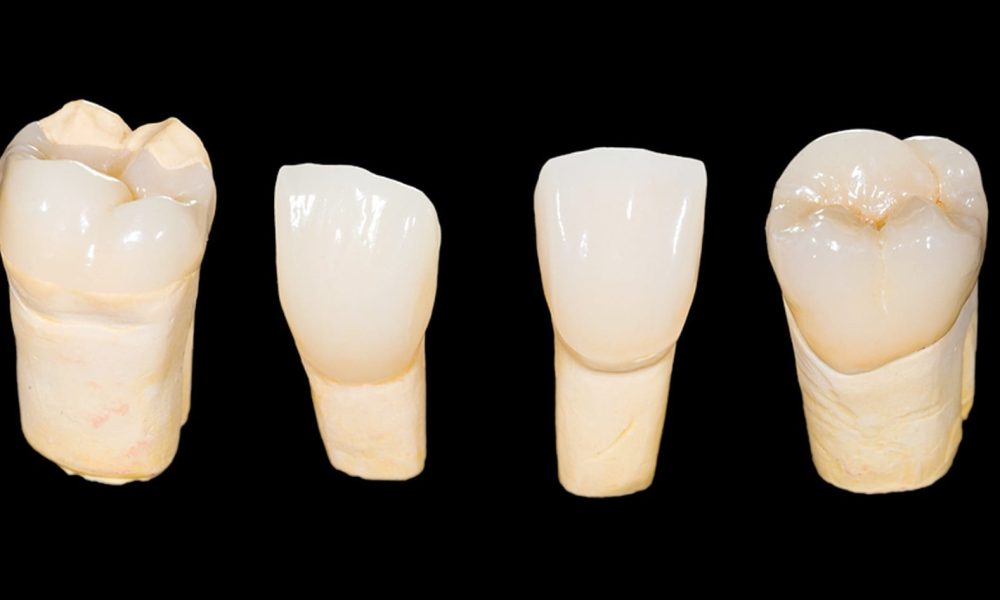 Zirconia crowns