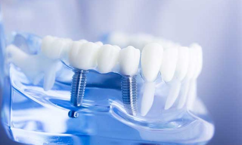 prosthodontics procedures