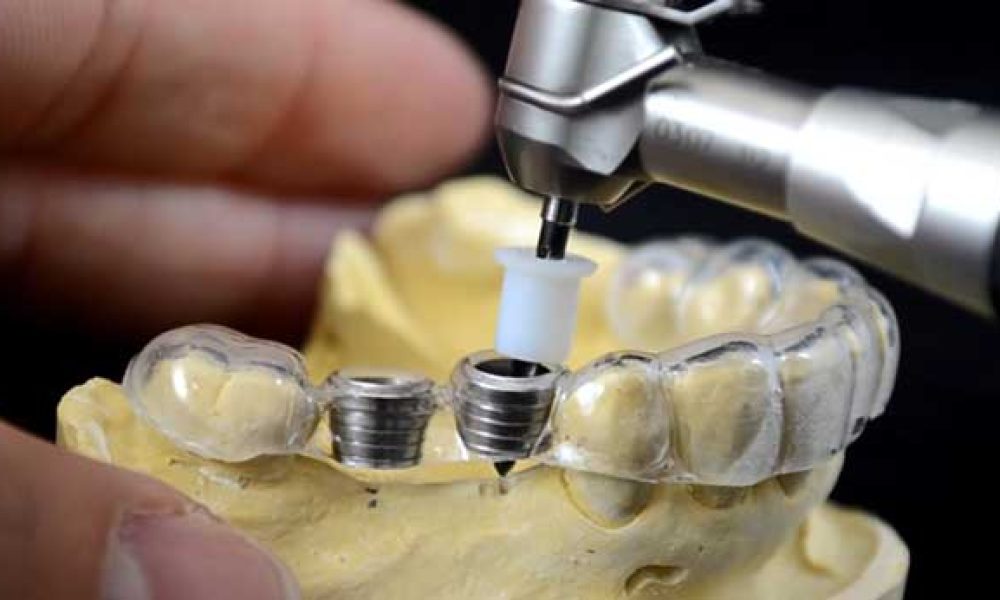 State-of-the-Art Surgical Guides
