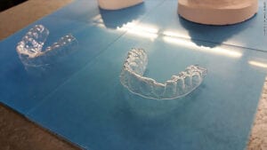 print your own braces
