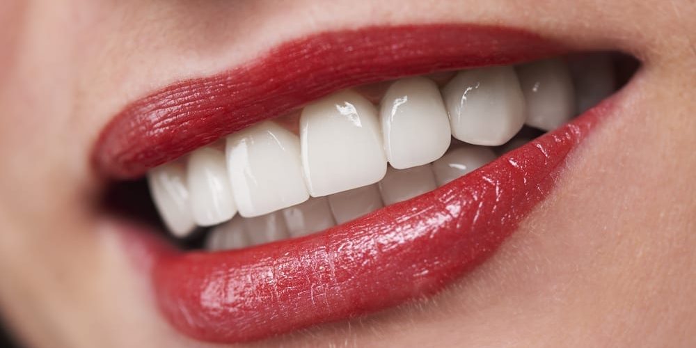 Veneers or Crowns: Which is the Best Choice for You?