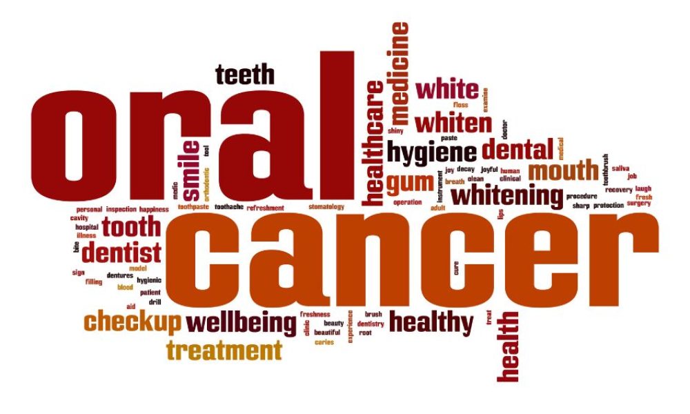 Do You Have Oral Cancer?