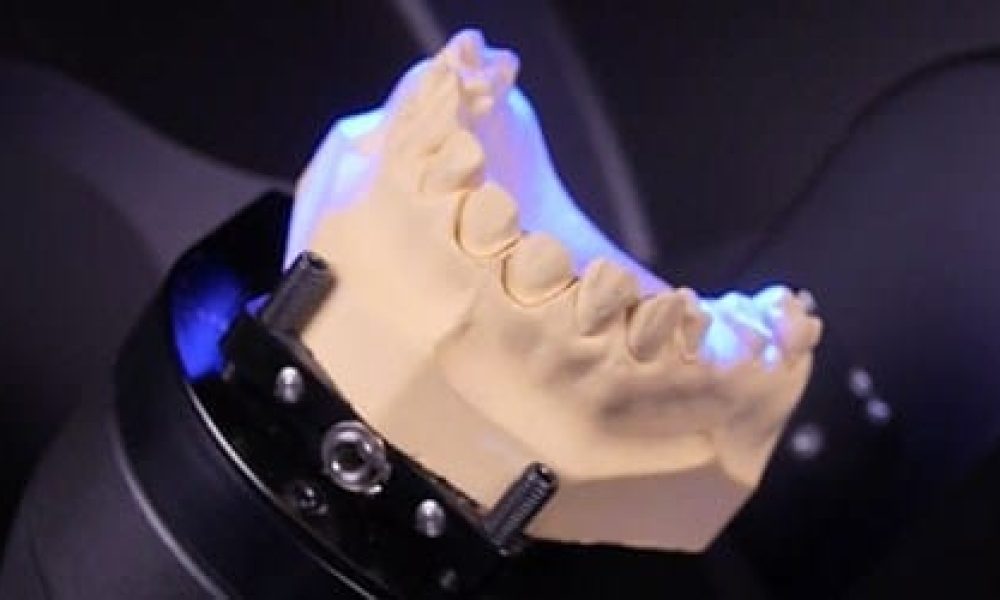 Get the Best Fit With Digital Dental Technology