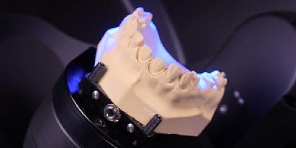 Get the Best Fit With Digital Dental Technology