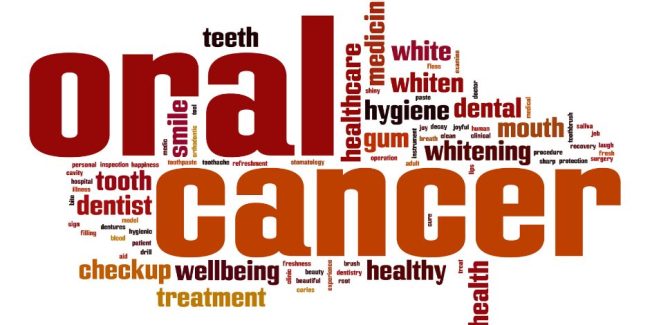 Do You Have Oral Cancer?