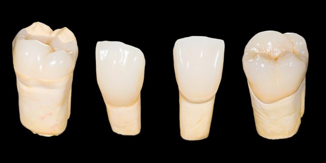 Zirconia Crowns & Bridges in Costa Rica