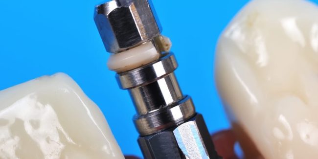 Save Money on Dental Implants in Costa Rica